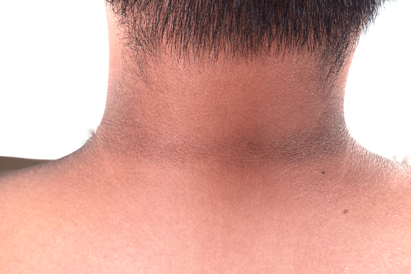 DESPIGMENTANTE PIEL DE ORO DE 120 ML