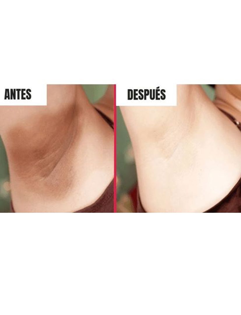 DESPIGMENTANTE SEN INTIMO