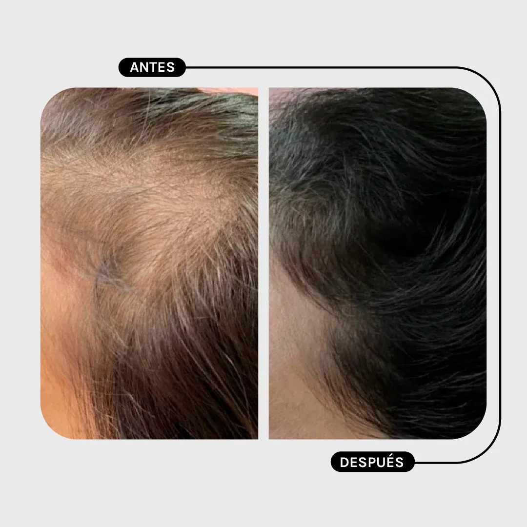 Shampoo AMINO+