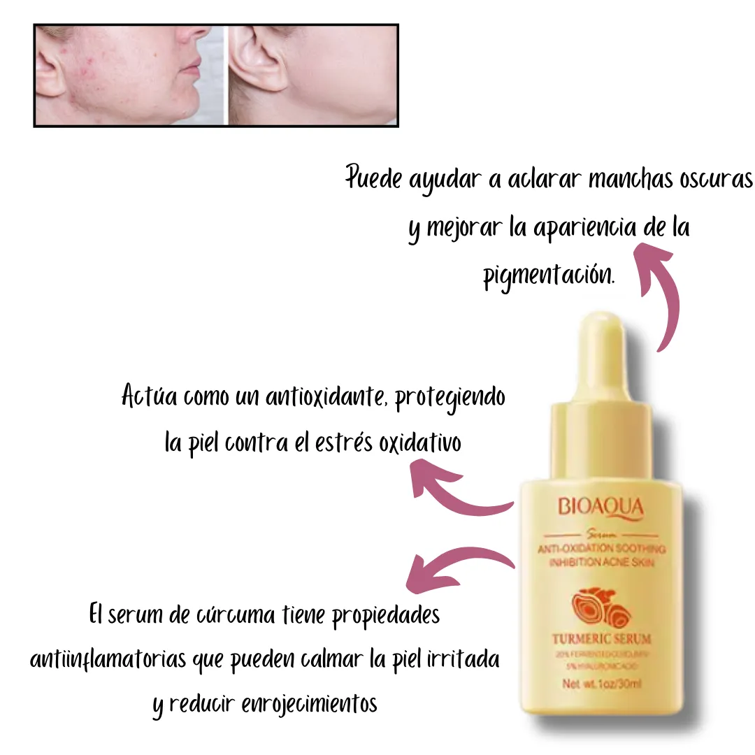 Kit x 3 de Sérum Faciales: Nicotinamida, Cúrcuma y Baba de Caracol - BIOAQUA