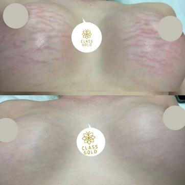 Aceite Multibeneficios Class Gold - imagen 3