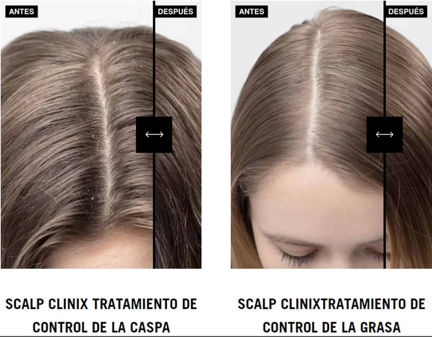 SCALP CLINIX TRIBOND