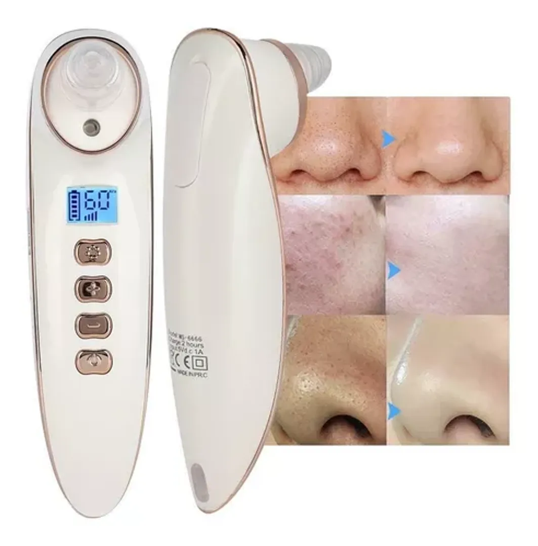 Extractor Espinillas Limpiador Poros Con Vapor Digital