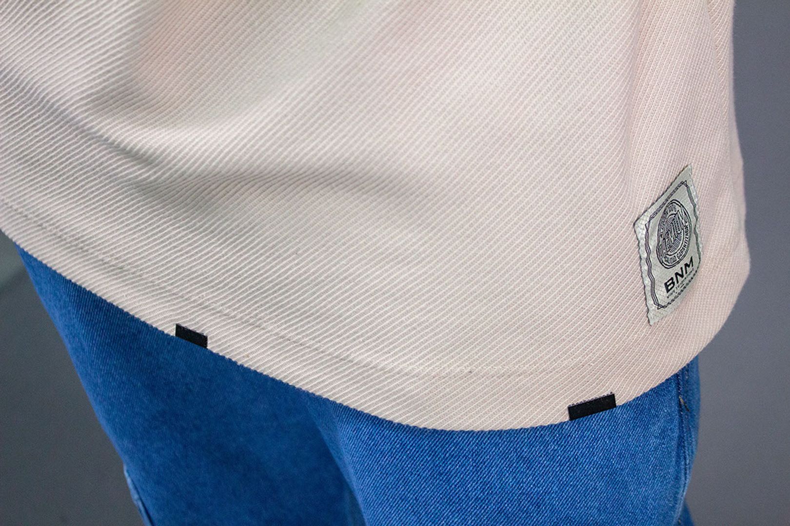 C. OVER FORENCI APLIQUES