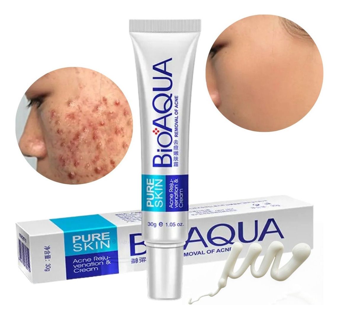 Crema antiacné 
