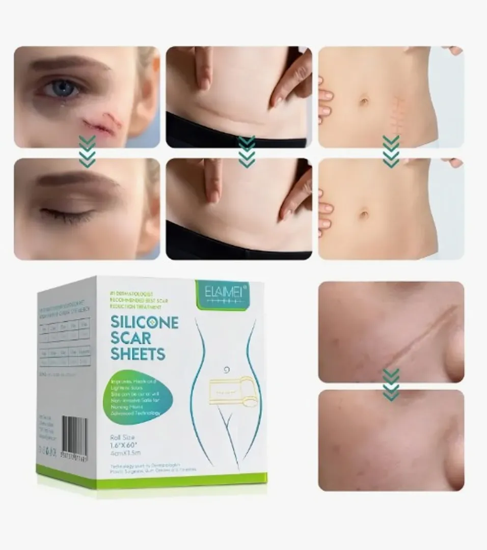 PARCHE DE SILICONA PARA CICATRICES 1.5M