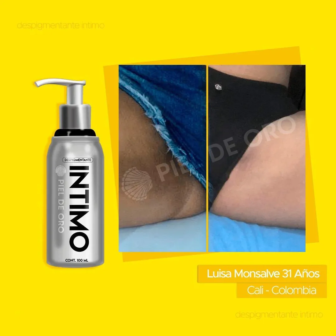 DESPIGMENTANTE PIEL DE ORO DE 120 ML