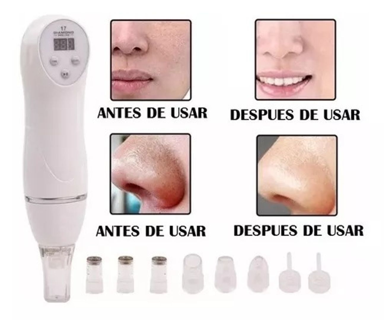 DIAMOND PEELING MICRODERMABRASION PARA EL CUIDADO FACIAL.