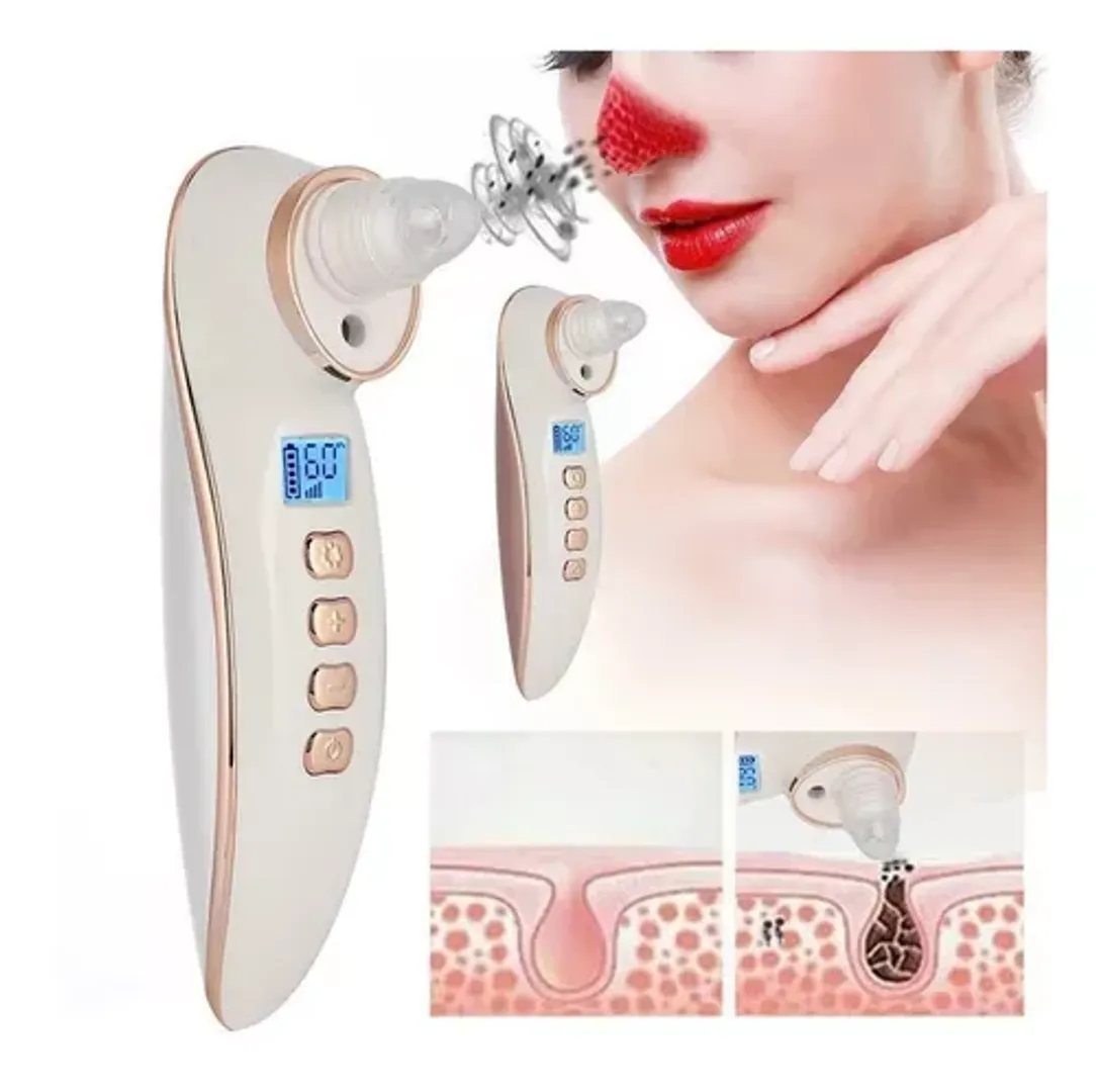 Extractor Espinillas Limpiador Poros Con Vapor Digital