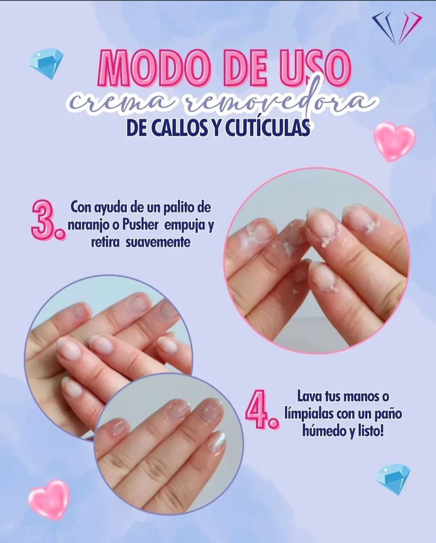 REMOVEDOR DE CALLOS