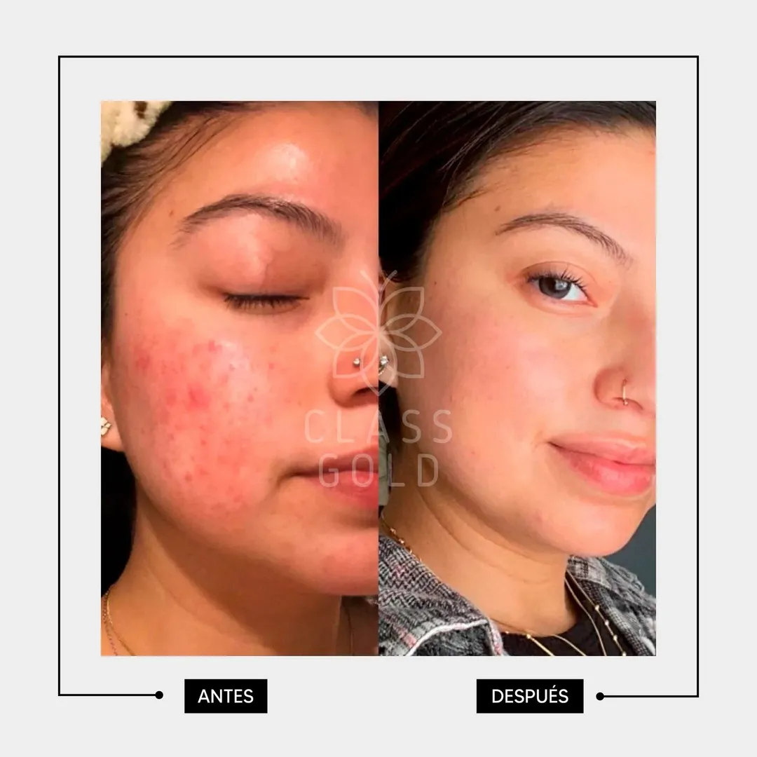 Serum facial + aloev