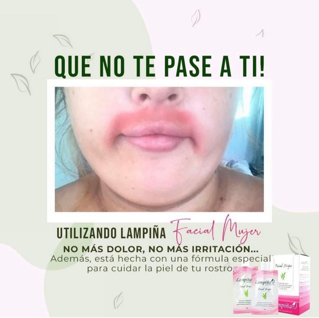 LAMPIÑA FACIAL
