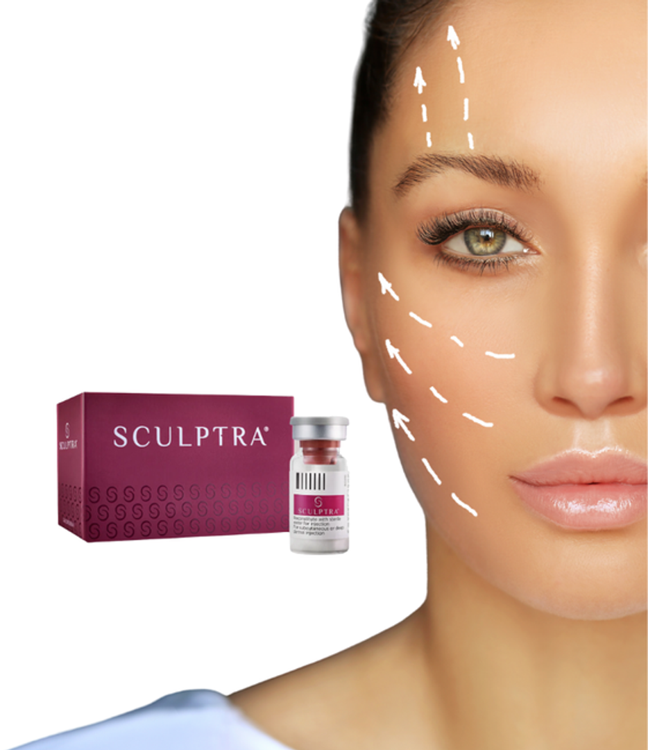 SCULPTRA ACIDO POLILACTICO BIOESTIMULADOR DE COLÀGENO