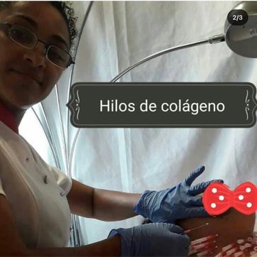 Imagen del producto Hilos de colágeno estimulación 
