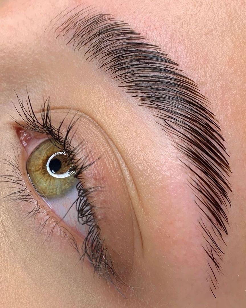 Lifting de cejas 