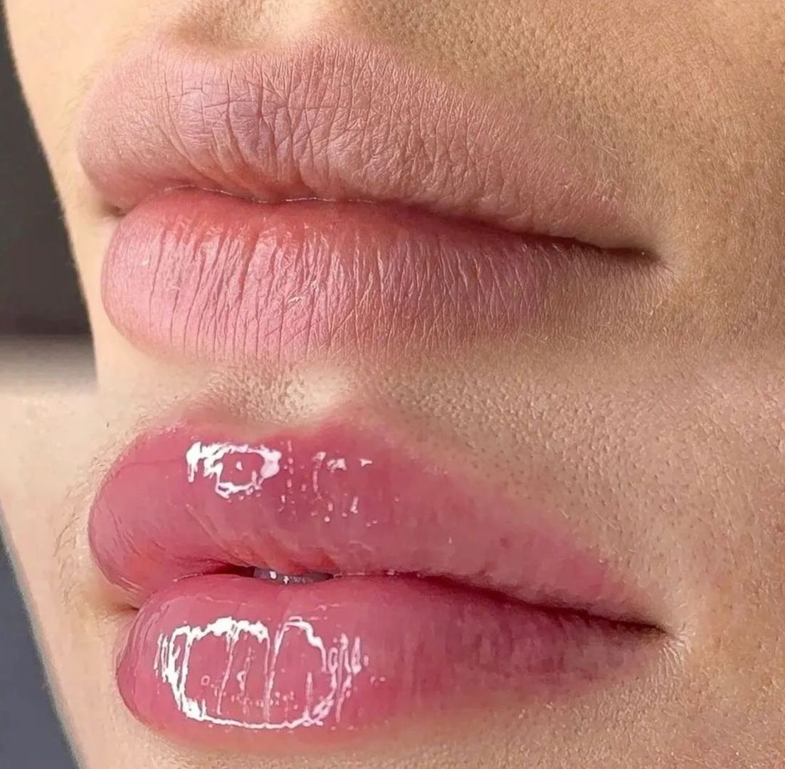 Hidratación de labios / hidralips 
