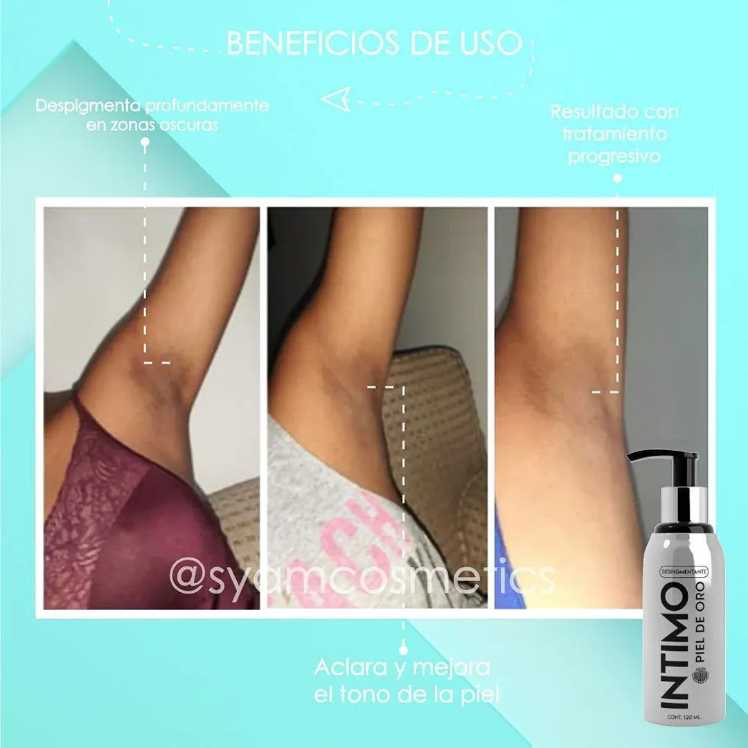 DESPIGMENTANTE PIEL DE ORO DE 120 ML