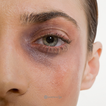 Imagen del producto REVITALIZACION DE OJERAS BOA