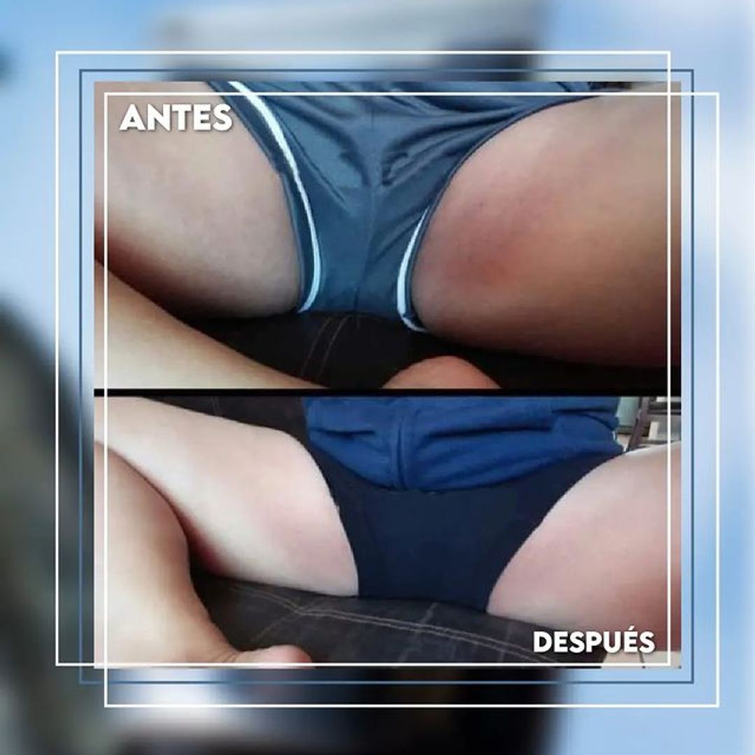 DESPIGMENTANTE PIEL DE ORO DE 120 ML