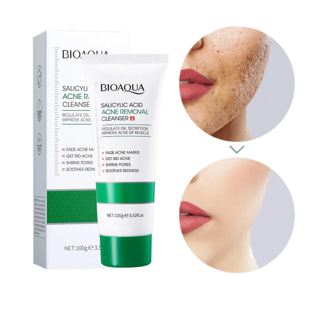 Jabon Facial de Acido Salicilico Bioaqua